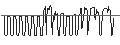 Intraday Chart für DISCOUNT-OPTIONSSCHEIN - BIONTECH ADR