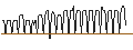 Intraday-grafiek van BONUS CAP ZERTIFIKAT - CECONOMY